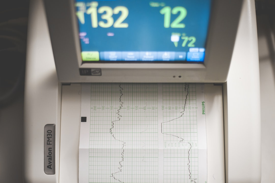 Fetal monitor screen displaying baby's heartbeat and printing waveform.